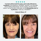 👑 Mother's Day Blowout: 70% OFF Ends Tonight! 🏆 Custom-Fit Dentures | Smile with Confidence