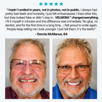 👑 Mother's Day Blowout: 70% OFF Ends Tonight! 🏆 Custom-Fit Dentures | Smile with Confidence
